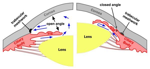 Types of Glaucoma